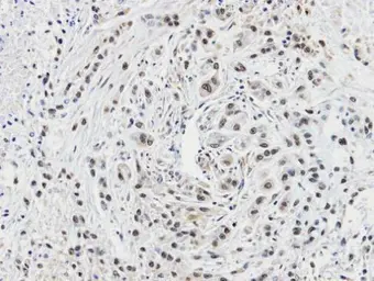 Anti-CacyBP antibody [C2C3], C-term used in IHC (Paraffin sections) (IHC-P). GTX104716