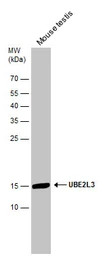Anti-UBE2L3 antibody used in Western Blot (WB). GTX104717