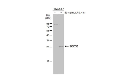 Anti-SOCS3 antibody [C2C3], C-term used in Western Blot (WB). GTX104720