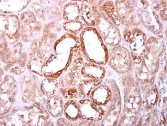 Anti-SOCS4 antibody [C3], C-term used in IHC (Paraffin sections) (IHC-P). GTX104721