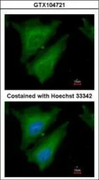 Anti-SOCS4 antibody [C3], C-term used in Immunocytochemistry/ Immunofluorescence (ICC/IF). GTX104721