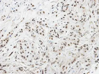 Anti-SPHK1 antibody [C3], C-term used in IHC (Paraffin sections) (IHC-P). GTX104724
