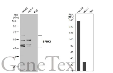 Anti-SPHK1 antibody [C3], C-term used in Western Blot (WB). GTX104724