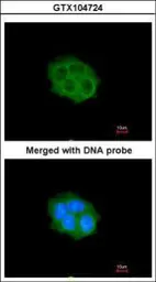 Anti-SPHK1 antibody [C3], C-term used in Immunocytochemistry/ Immunofluorescence (ICC/IF). GTX104724