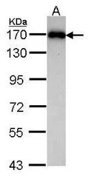 Anti-MAGI-2 antibody [C3], C-term used in Western Blot (WB). GTX104739