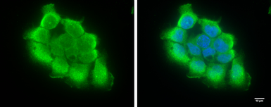 Anti-TRIF antibody [C3], C-term used in Immunocytochemistry/ Immunofluorescence (ICC/IF). GTX104744