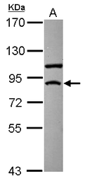Anti-TRIF antibody [C3], C-term used in Western Blot (WB). GTX104744