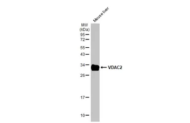 Anti-VDAC2 antibody [C2C3], C-term used in Western Blot (WB). GTX104745