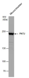 Anti-PATJ antibody [N1], N-term used in Western Blot (WB). GTX104753