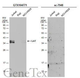 Anti-LAT antibody used in Western Blot (WB). GTX104771