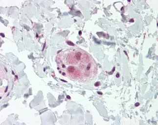 Anti-WRCH1 antibody used in IHC (Paraffin sections) (IHC-P). GTX104779