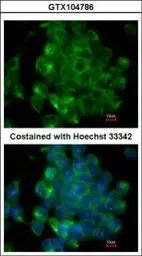 Anti-SIPA1 antibody [C3], C-term used in Immunocytochemistry/ Immunofluorescence (ICC/IF). GTX104786