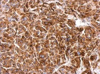 Anti-SIPA1 antibody [C3], C-term used in IHC (Paraffin sections) (IHC-P). GTX104786
