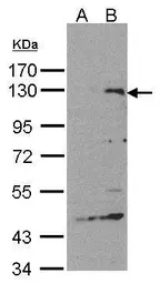 Anti-SIPA1 antibody [C3], C-term used in Western Blot (WB). GTX104786