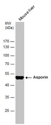Anti-Asporin antibody [N3C1], Internal used in Western Blot (WB). GTX104790