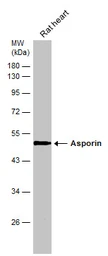 Anti-Asporin antibody [N3C1], Internal used in Western Blot (WB). GTX104790