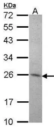 Anti-Amisyn antibody [N1N2], N-term used in Western Blot (WB). GTX104797