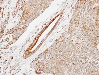 Anti-HSP22 antibody [C2C3], C-term used in IHC (Paraffin sections) (IHC-P). GTX104815