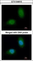 Anti-HSP22 antibody [C2C3], C-term used in Immunocytochemistry/ Immunofluorescence (ICC/IF). GTX104815
