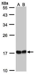 Anti-HSP22 antibody [C2C3], C-term used in Western Blot (WB). GTX104815