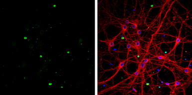Anti-OLIG1 antibody [C2C3], C-term used in Immunocytochemistry/ Immunofluorescence (ICC/IF). GTX104823