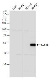 Anti-KLF15 antibody [N1], N-term used in Western Blot (WB). GTX104839