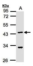Anti-KLF15 antibody [N1], N-term used in Western Blot (WB). GTX104839