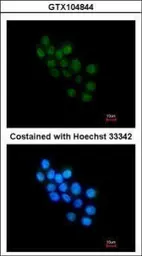 Anti-FOXB1 antibody [C2C3], C-term used in Immunocytochemistry/ Immunofluorescence (ICC/IF). GTX104844