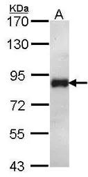 Anti-FOXK2 antibody [C3], C-term used in Western Blot (WB). GTX104848