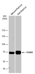 Anti-FOXN1 antibody [C3], C-term used in Western Blot (WB). GTX104849
