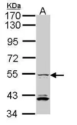 Anti-IRF5 antibody [C3], C-term used in Western Blot (WB). GTX104852