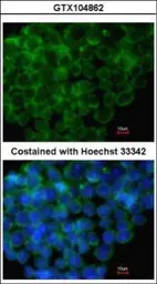 Anti-IRF6 antibody [C3], C-term used in Immunocytochemistry/ Immunofluorescence (ICC/IF). GTX104862