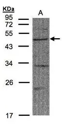 Anti-FBXW2 antibody used in Western Blot (WB). GTX104863
