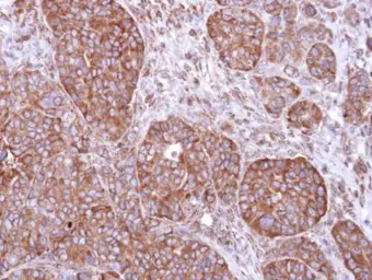 Anti-FBXL2 antibody [N1], N-term used in IHC (Paraffin sections) (IHC-P). GTX104864