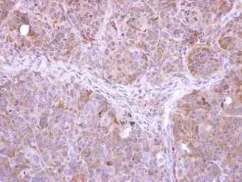 Anti-FBXL12 antibody [C2C3], C-term used in IHC (Paraffin sections) (IHC-P). GTX104870