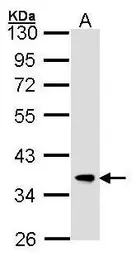 Anti-FBXL12 antibody [C2C3], C-term used in Western Blot (WB). GTX104870