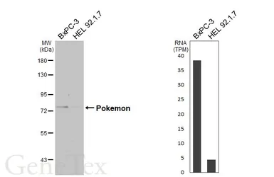 Anti-Pokemon antibody [C3], C-term used in Western Blot (WB). GTX104876