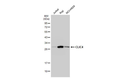 Anti-CLIC4 antibody used in Western Blot (WB). GTX104888