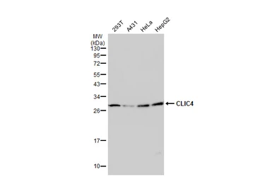 Anti-CLIC4 antibody used in Western Blot (WB). GTX104888