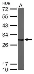 Anti-CTDSP2 antibody used in Western Blot (WB). GTX104889