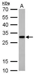 Anti-CTDSP2 antibody used in Western Blot (WB). GTX104889