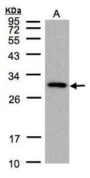 Anti-CTDSP2 antibody used in Western Blot (WB). GTX104889