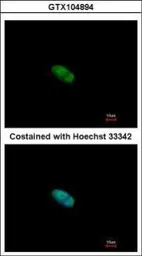Anti-ZNF148 antibody [N1N2], N-term used in Immunocytochemistry/ Immunofluorescence (ICC/IF). GTX104894