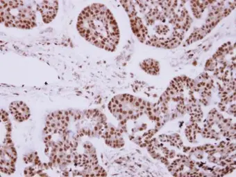Anti-ZNF148 antibody [N1N2], N-term used in IHC (Paraffin sections) (IHC-P). GTX104894