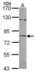 Anti-ZNF148 antibody [N1N2], N-term used in Western Blot (WB). GTX104894