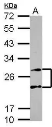 Anti-PSMA4 antibody used in Western Blot (WB). GTX104896