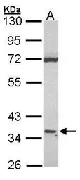 Anti-CD1d antibody [N2C3] used in Western Blot (WB). GTX104898