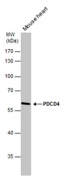 Anti-PDCD4 antibody used in Western Blot (WB). GTX104901
