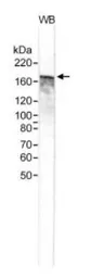 Anti-NCOA2 antibody used in Western Blot (WB). GTX10491