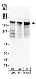 Anti-NCOA2 antibody used in Western Blot (WB). GTX10491